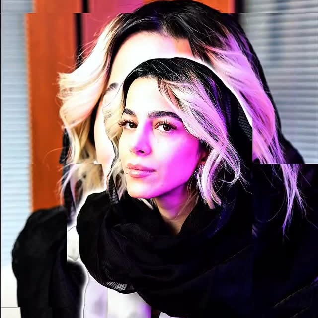 نمونه کار جراحی بینی ۵