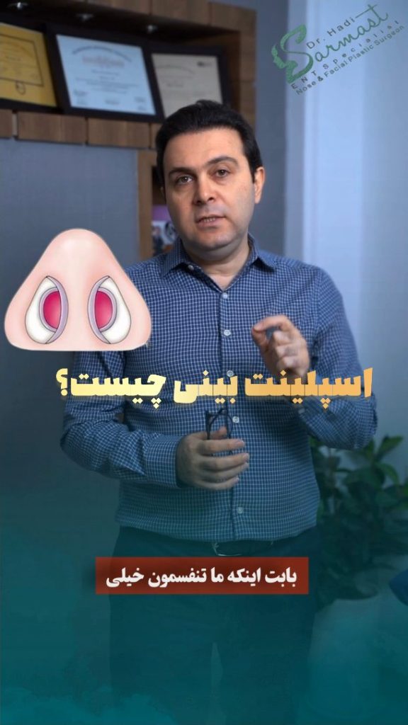 اسپلینت داخلی یا تامپون بینی؟ کدام بعد از جراحی بینی بهتر است؟