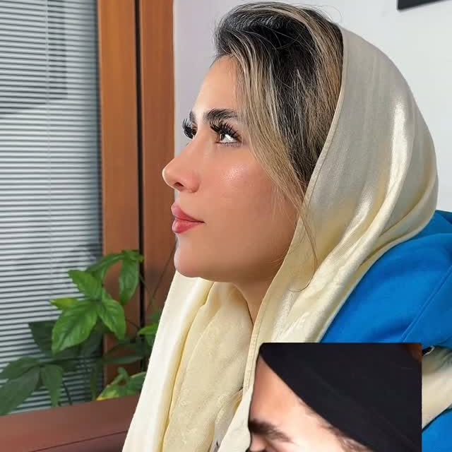 گالری ویدیوهای کلینیک جراحی بینی