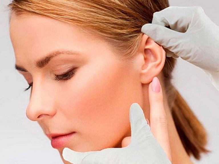 عمل جراحی بازسازی گوش؛ راهنمای کامل اتوپلاستی