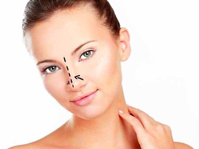 راهنمای جامع بیماران جراحی بینی