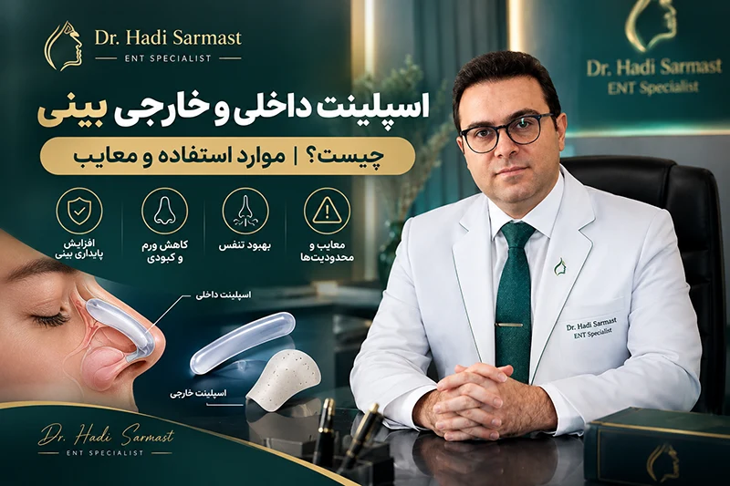 اسپلینت داخلی و خارجی بینی بعد از جراحی بینی