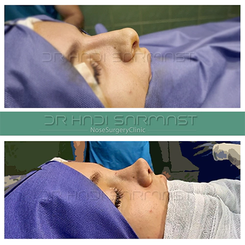 بهترین-جراح-بینی-در-تهران