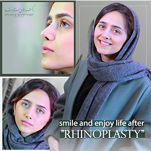 بهترین-جراح-بینی-نیمه-فانتزی-تهران