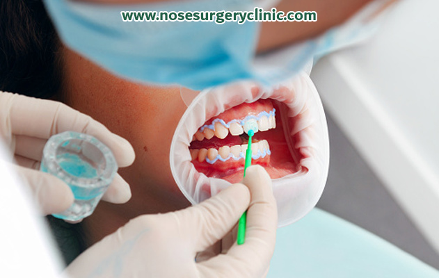 بهترین-زمان-مراجعه-به-دندانپزشکی-بعد-از-جراحی-بینی