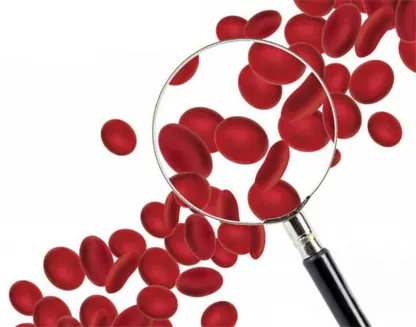 تست-انعقاد-خون