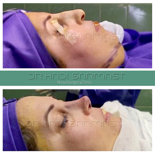 جراح-بینی-خوب-در-تهران