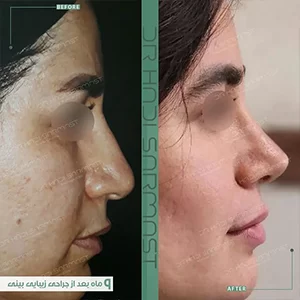 جراح-بینی-خوب-در-پاسداران