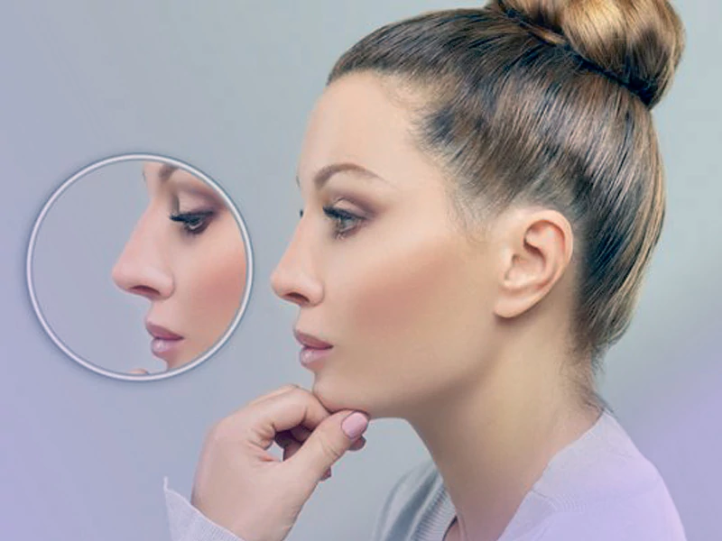 اطلاعات جامع انتخاب بهترین جراح بینی با نمونه کارهای جذاب