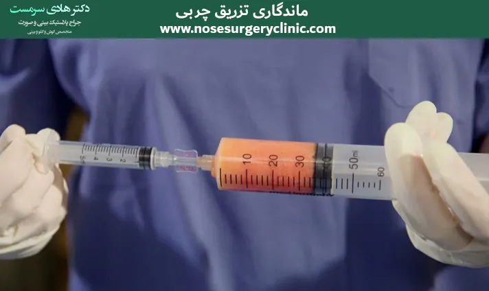 ماندگاری تزریق چربی