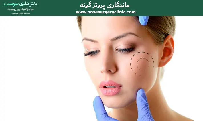 مدت زمان ماندگاری پروتز گونه