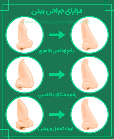 مزایای-عمل-جراحی-بینی